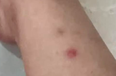 番禺臭猫事件引热议，记者现场“yue”揭两难