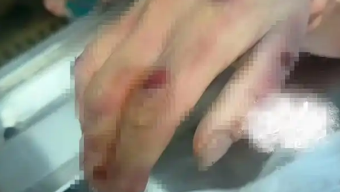 女子骑车被狗撞倒身亡，狗主人就在旁边！狗主人：赔不起