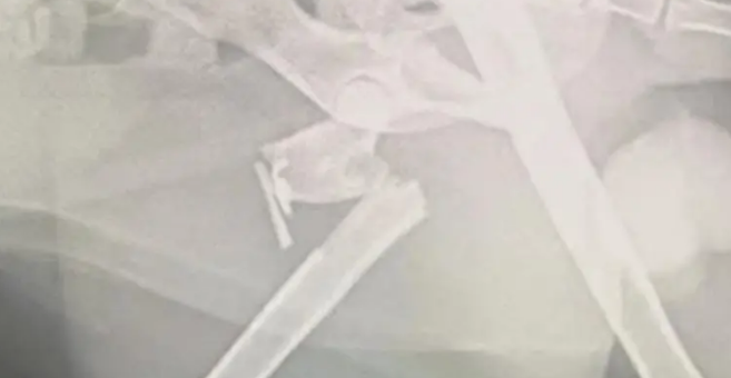 小姐姐发现一只被苍蝇包围的流浪猫，幸好小姐姐比死神先来到