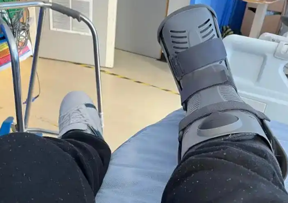 睡梦中被爱犬咬掉一根脚趾！巴西男子下半身瘫痪