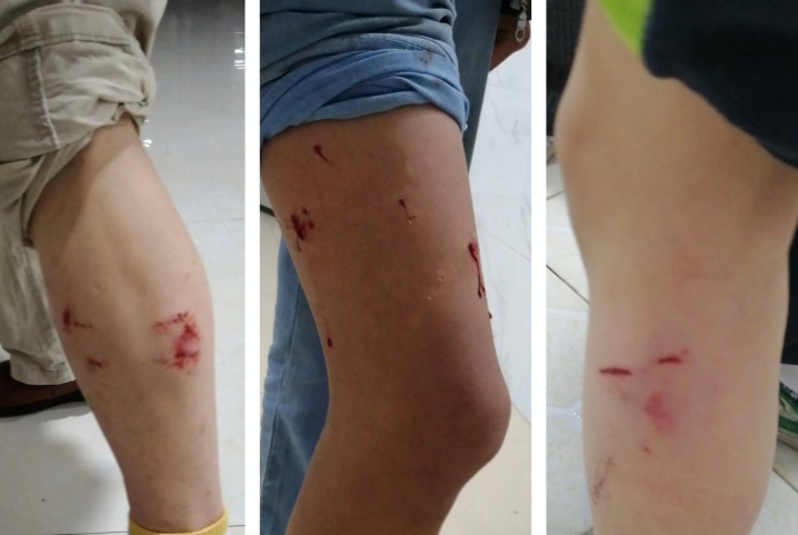 3条狗咬伤16人！湖南当地：已找到狗的主人