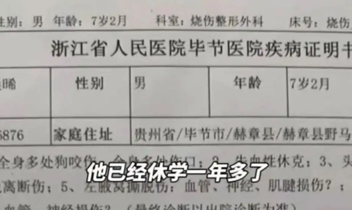 7岁男孩被3只大型犬撕咬：左耳咬掉，头皮撕裂