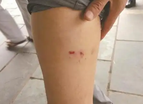 天热动物攻击性强 被猫狗咬伤尽早接种疫苗