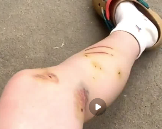 女子被养了3年多的猫咪攻击 腿上遍布伤痕