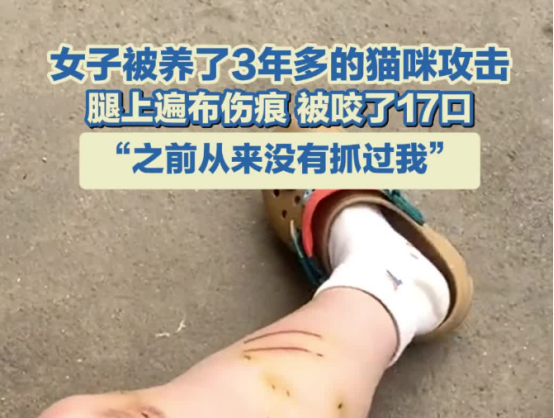 女子被养了3年多的猫咪攻击 腿上遍布伤痕