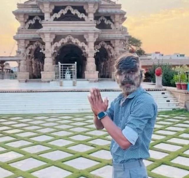 18岁男孩患罕见“狼人综合征”，毛发覆盖面部