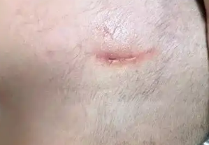 1岁萌娃突遭宠物狗扑咬！头面部多处撕裂紧急送医