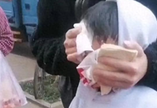 恶犬伤人，为何狗主人总能隐身？