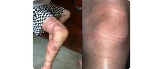 深圳海滩惊现剧毒水母！被蛰伤严重可致命！