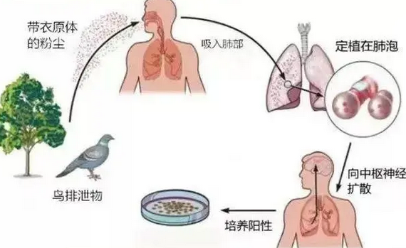 母女俩双双确诊，严重可致死！竟和家中宠物有关