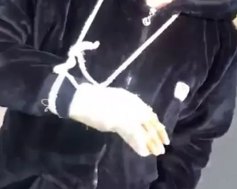 看到自己家黑狗怎么狗腿瘸了，后头一看笑喷：你学的还挺像！ 