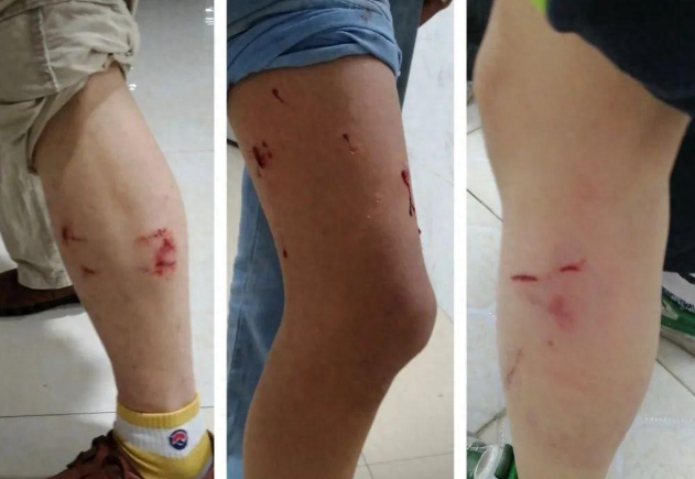 湖南一地3条狗咬伤16人，警方正在处置