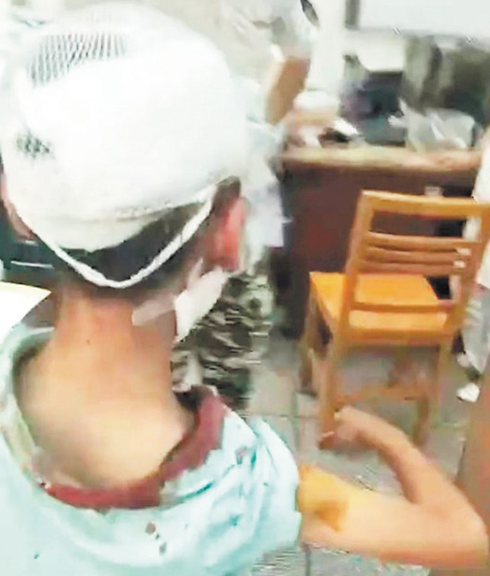 男孩被阿拉斯加犬突袭咬伤 夏季谨防犬只袭击人群