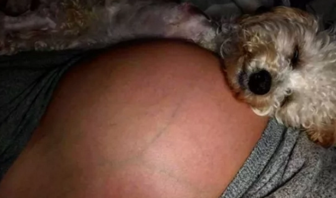 一只残疾的狗狗遭主人抛弃，孕妇领养后，改变太多了