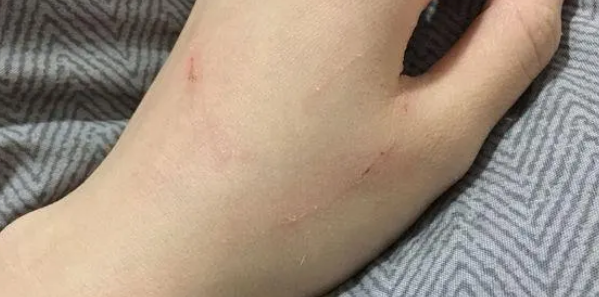 小猫不让网友碰它，第一次碰它就被抓成这样了，真厉害